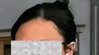 Anakwalikota 1