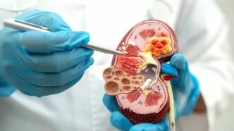 Penyebab Gagal Ginjal Gejala dan Pencegahannya