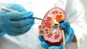 Penyebab Gagal Ginjal Gejala dan Pencegahannya