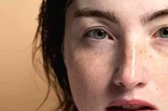 Menghilangkan flek hitam menurut dokter medis