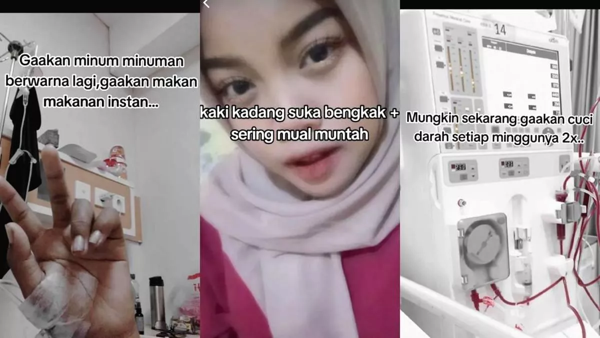 Wanita asal tangerang kena gagal ginjal stadium