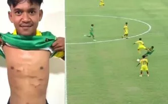 Firman Nugraha, Pemain Perseta Tulungagung, Jadi Korban Tendangan Brutal di Liga 4 Jatim, Komdis PSSI Minta Hukuman Berat