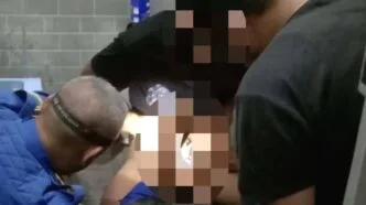 Remaja Kuningan Pasang Cincin Titanium di Alat Vital, Berakhir Minta Bantuan Damkar