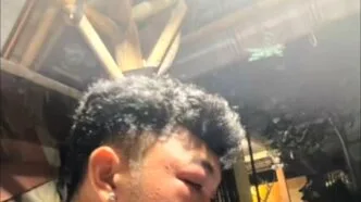 Tanpa Alat Pelindung, Pemuda di Bali Diserang Tawon Saat Coba Musnahkan Sarang di Atap Rumah