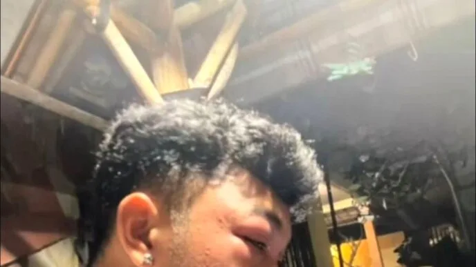 Tanpa Alat Pelindung, Pemuda di Bali Diserang Tawon Saat Coba Musnahkan Sarang di Atap Rumah